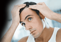 hair-loss-for-men